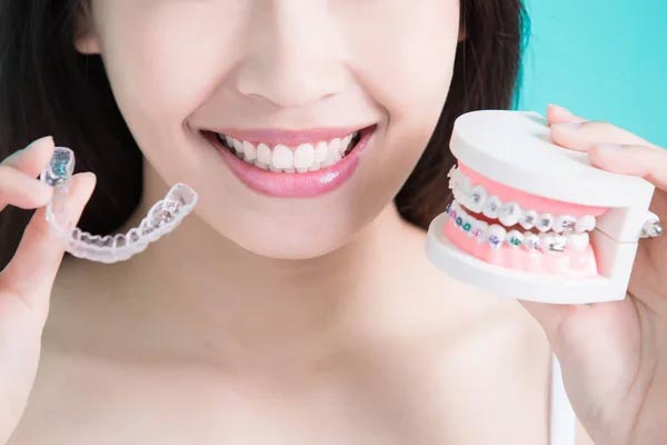 invisalign-perks-during-the-treatment-img