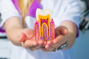 dental fillings and root canal treatment in Calgary