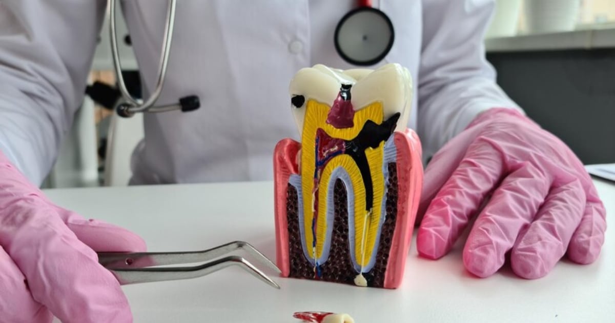 what happens to your body after a root canal