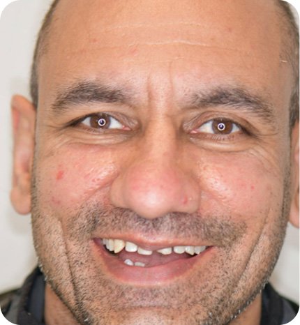 before dental treatment smile